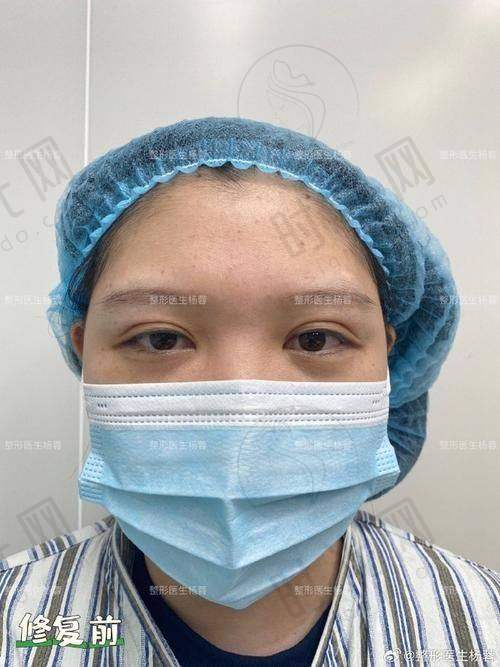 崔东医生口碑评价及反馈内容