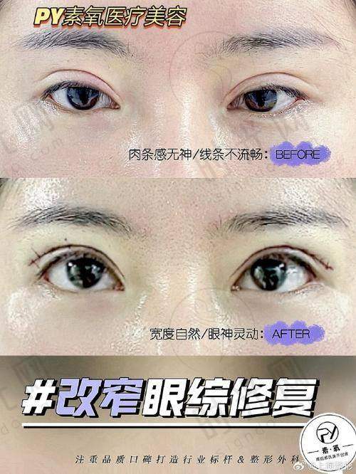 李罡医生坐诊哪个医院？