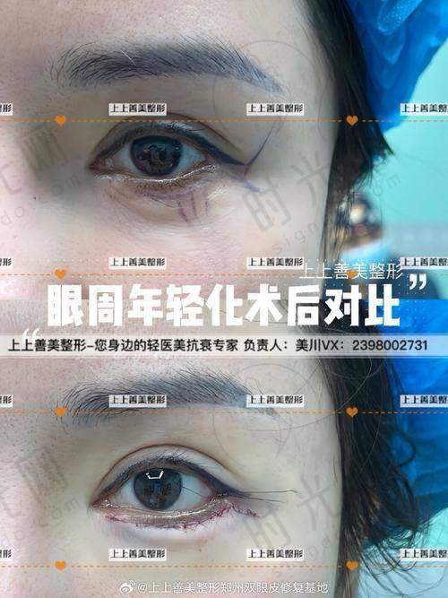 崔东医生执医荣誉