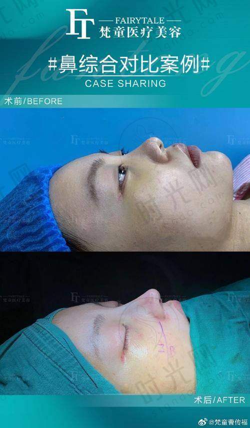 肖鹏飞医生擅长项目