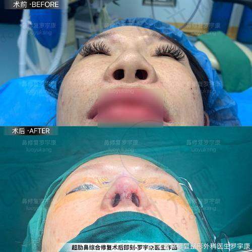 崔东医生坐诊哪个医院？