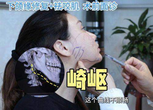 刘志刚医生口碑评价及反馈内容