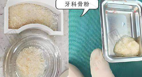 三、魏永祥医生技术水平高