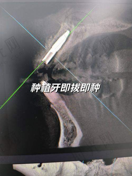 杨晓喻医生擅长项目