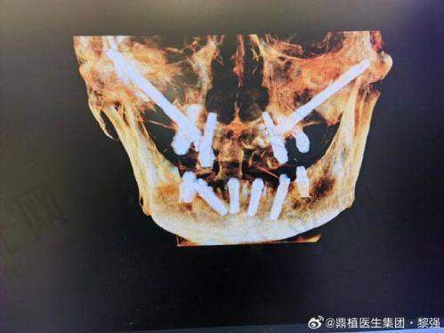 易纯医生坐诊哪个医院？
