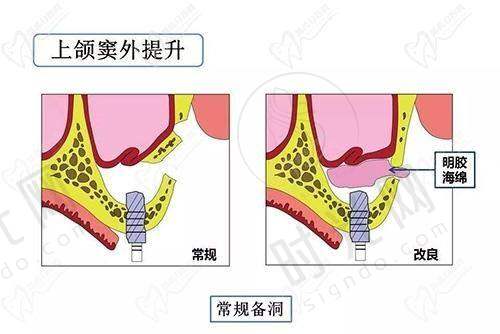吴王喜医生擅长项目