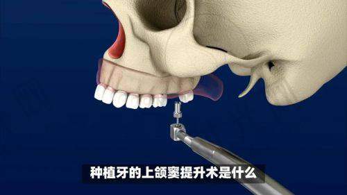 吴王喜医生价格表（2025年全新）