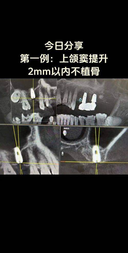 赖春花医生个人资料简介