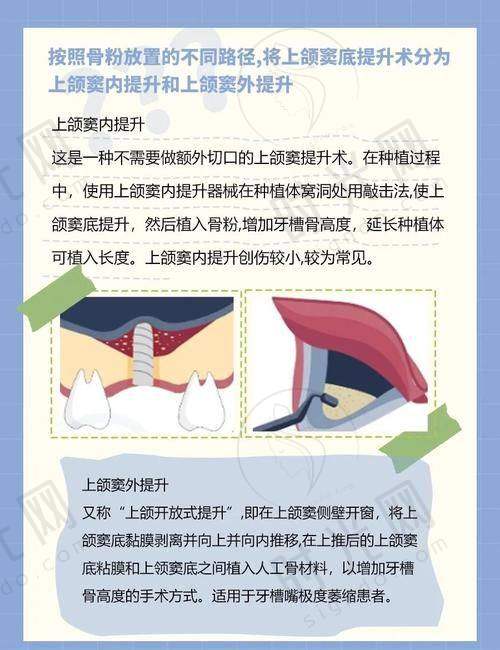 三、黄宝鑫医生技术水平高