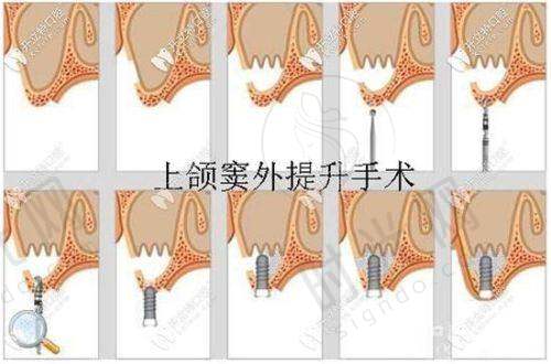 罗智斌医生坐诊哪个医院？