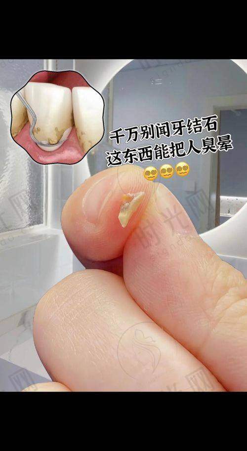 甄敏医生预约挂号