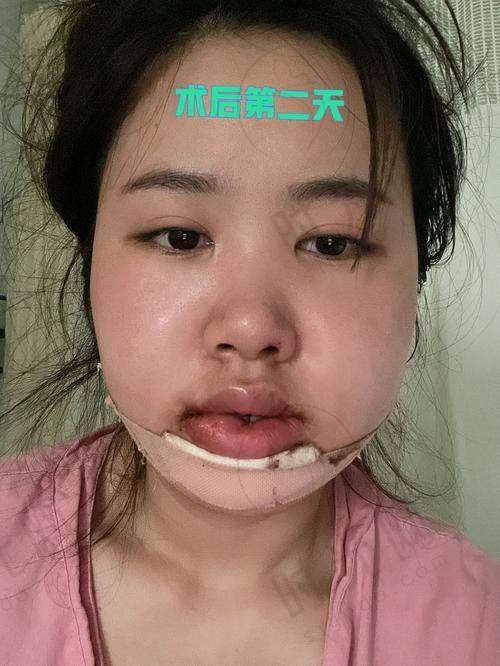 吴尽红医生口碑评价及反馈内容