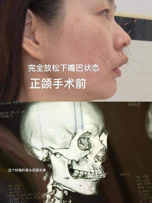 周传丽医生预约挂号