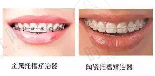 周传丽医生擅长项目