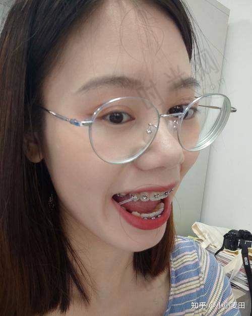 吴尽红医生擅长项目