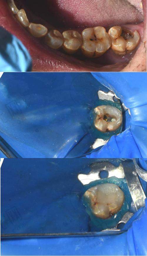 张美华医生预约挂号