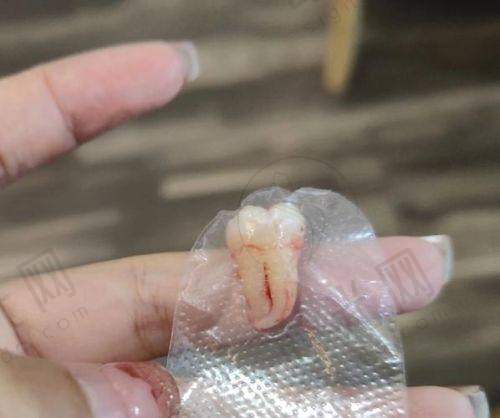 张美华医生价格表(2025年全新)