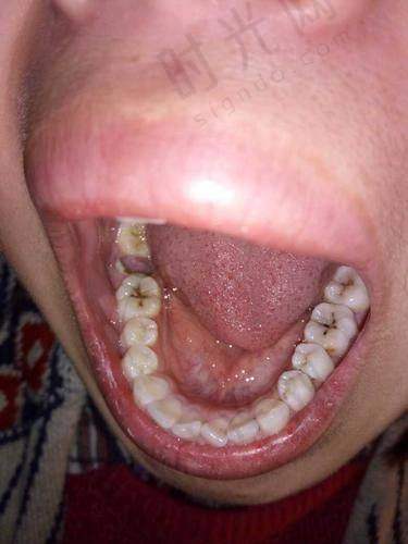 张美华医生技术水平高