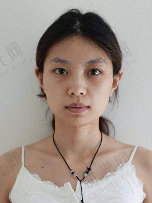 程宁新医生预约挂号