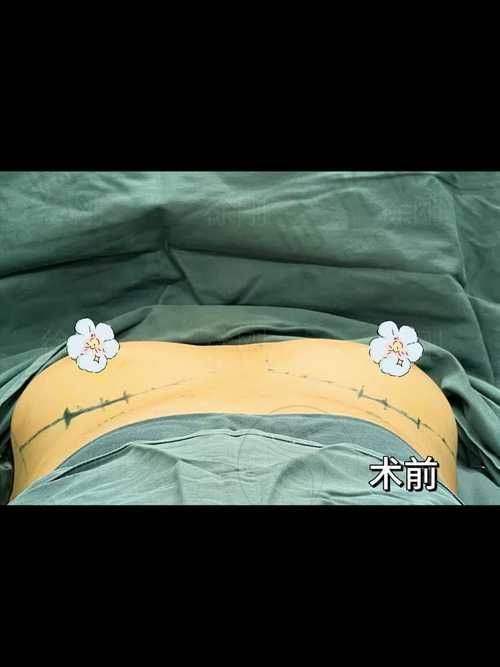 李罡医生预约挂号