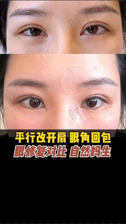 肖强医生价格表（2025年全新）