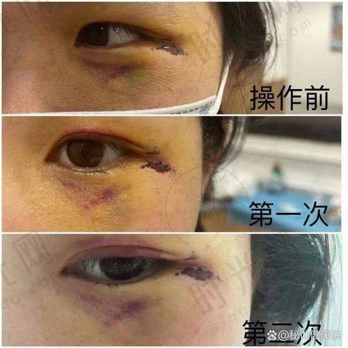 肖强医生坐诊哪个医院？