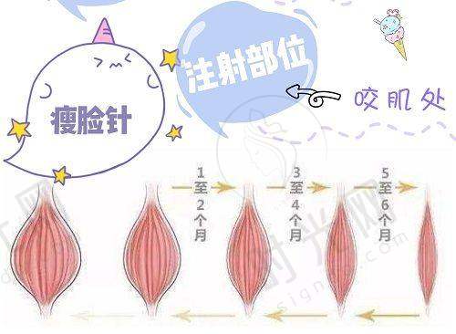 总结