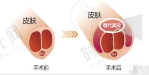 武汉八爪鱼紧缩术医院口碑分析