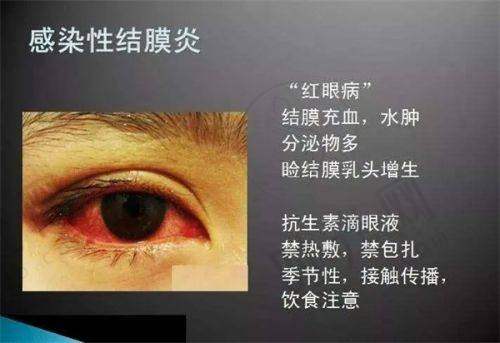重庆大坪医院眼科24小时人工电话023 - 68746066医生