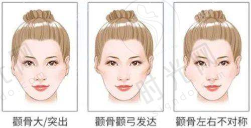 佛山曙光金子医院的口碑情况