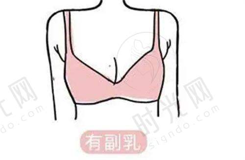 7D聚拉提价格详情