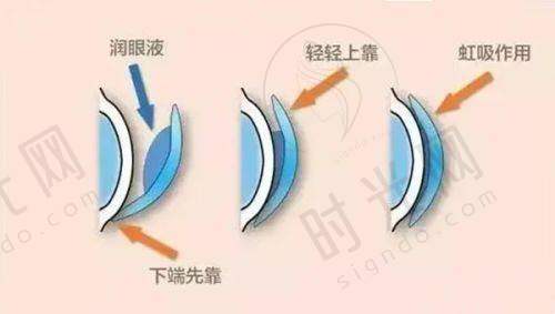 种植牙后悔了可以取出来吗