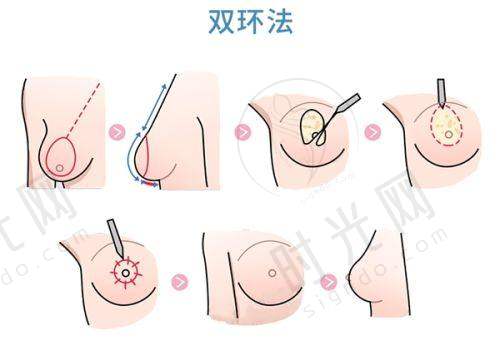 其他信息