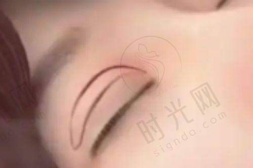 泉州正规整形医院排名前十介绍