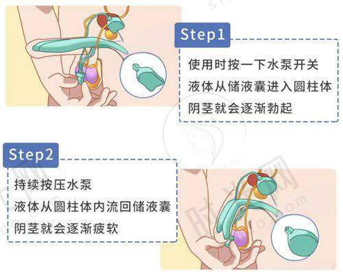 深圳博爱医院美容科隆胸收费