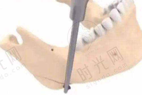 总结