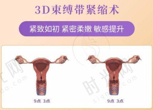 河南郑州华仁植发医院的地址及建议