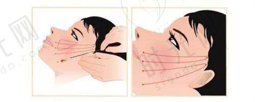 总结
