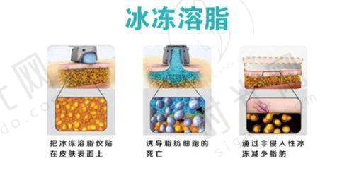 深圳博爱医院美容科吸脂收费