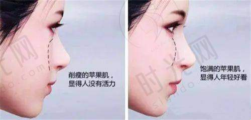 总结