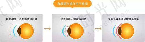 刘苏冰医生坐诊的郑州视光眼科医院情况