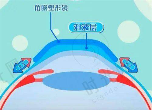 眼科手术价格明细