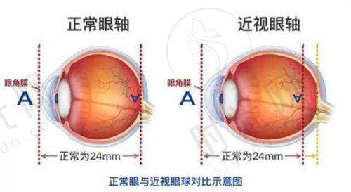 爱尔眼科配镜服务优势