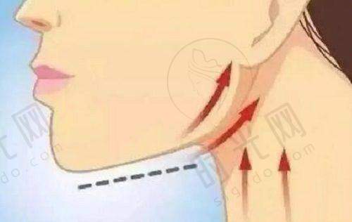 薇旖美三型胶原蛋白有哪些型号？极纯III型和至真III型有什么区别？
