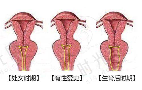 薇旖美重组XVII型（17型）是什么？适合哪些人群？