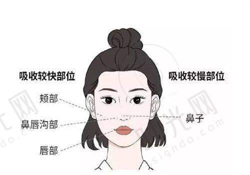 薇旖美胶原蛋白打泪沟：告别“疲惫感”的填充秘诀