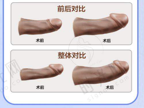 总结