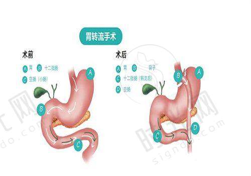 钻石金雕价格揭秘：8000-20000元/部位，哪些因素影响报价？