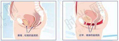 薇旖美胶原蛋白打眼周：从细纹到黑眼圈的“逆袭”