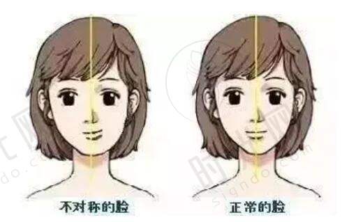 郑州王杨医生眼袋修复卧蚕多少钱